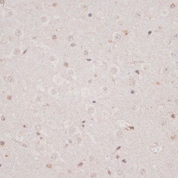 Immunohistochemistry - KDM3A antibody (144-011960)