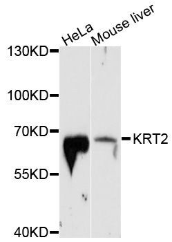Western blot - KRT2 Polyclonal Antibody (144-10375)