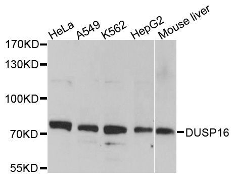 Western blot - DUSP16 Polyclonal Antibody (144-010155)