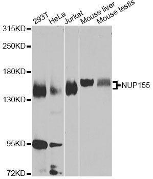 Western blot - NUP155 Antibody (144-07764)