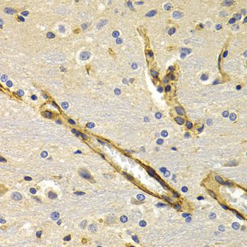 Immunohistochemistry - KLKB1 antibody (144-05318)