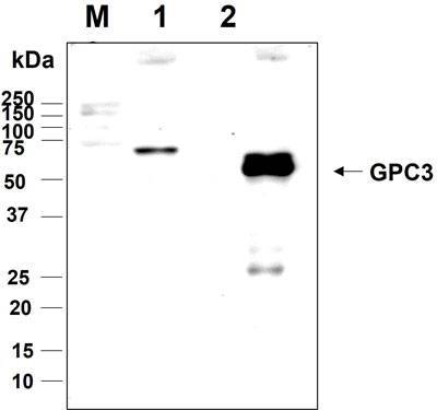 Western blot