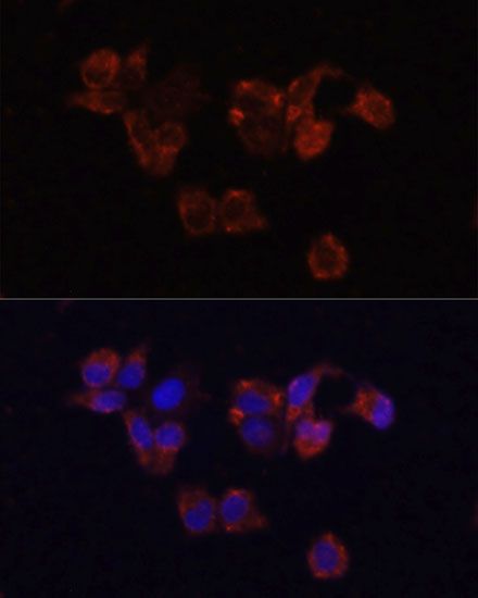 Immunofluorescence - LAMP1 Polyclonal Antibody (144-02582)
