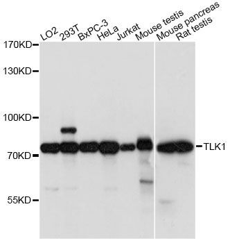 Western blot - TLK1 Polyclonal Antibody (144-014831)