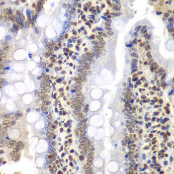 Immunohistochemistry - PSMC3 Antibody (144-01986)