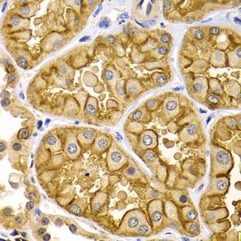 Immunohistochemistry - KRT5 Antibody (144-02662)