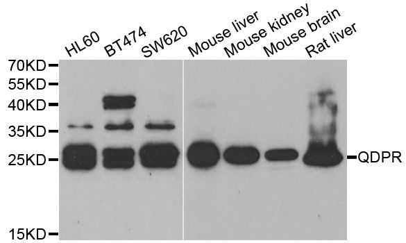 Western blot - QDPR Polyclonal Antibody (144-05733)