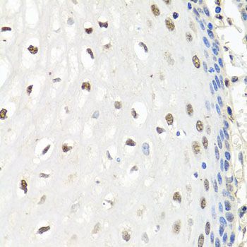 Immunohistochemistry - CNOT8 antibody (144-08058)