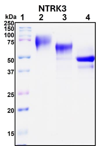 SDS-PAGE Image