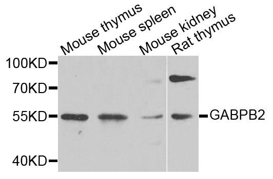 Western blot - GABPB2 antibody (144-03543)