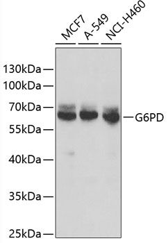 Western blot