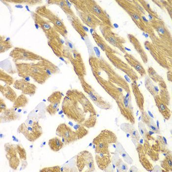 Immunohistochemistry - AIMP1 antibody (144-05301)