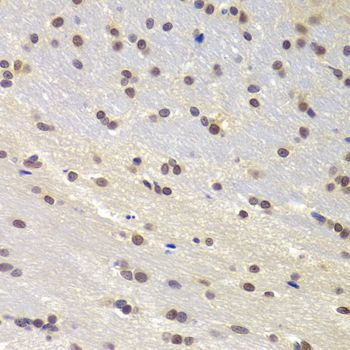 Immunohistochemistry - PRPF3 Polyclonal Antibody (144-05482)
