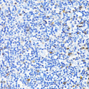 Immunohistochemistry - [KO Validated] S100A4 Polyclonal Antibody (144-01631)