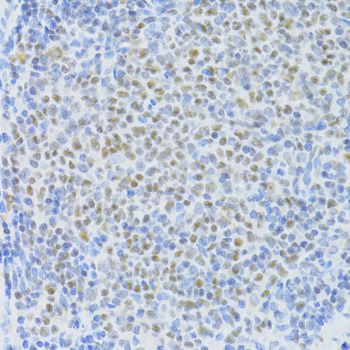 Immunohistochemistry - SNRNP70 antibody (144-06065)