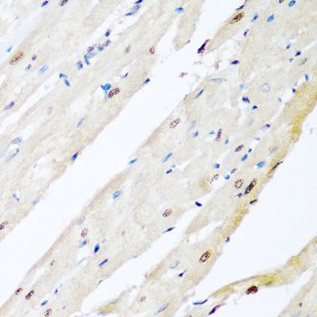Western blot - VCP Polyclonal Antibody (144-60308)