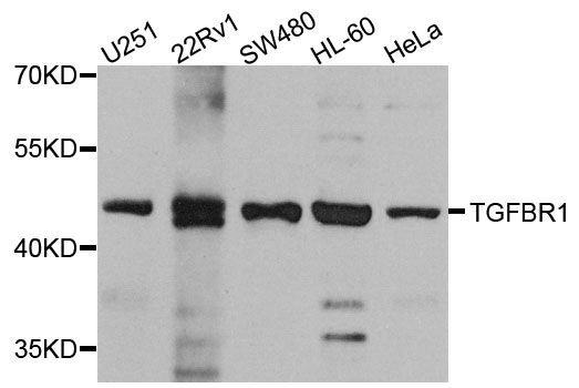 Western blot - TGFBR1 Polyclonal Antibody (144-00708)