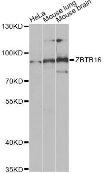 Western blot - ZBTB16 Antibody (144-05863)