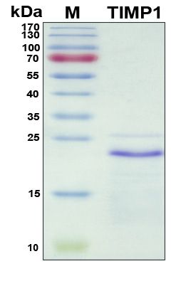 SDS-PAGE
