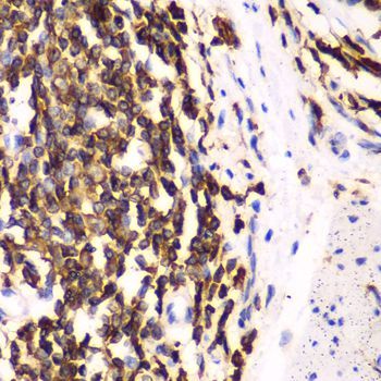 Immunohistochemistry - HCLS1 antibody (144-02165)