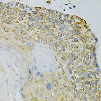 Immunohistochemistry - GPX4 Antibody (144-01933)