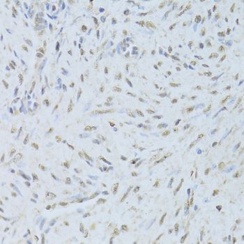 Immunohistochemistry - TARDBP Polyclonal Antibody (144-01183)