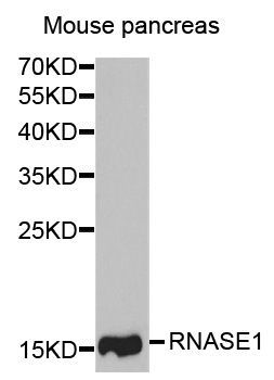 Western blot - RNASE1 antibody (144-06202)