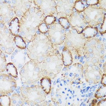 Immunohistochemistry - NEFH antibody (144-08442)
