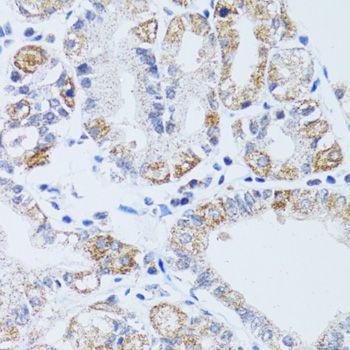 Immunohistochemistry - DNAJC19 Polyclonal Antibody (144-05146)