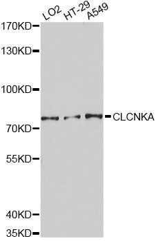 Western blot - CLCNKA Antibody (144-03792)