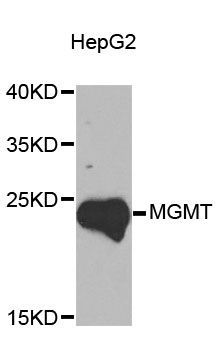 Western blot - MGMT Polyclonal Antibody (144-00693)