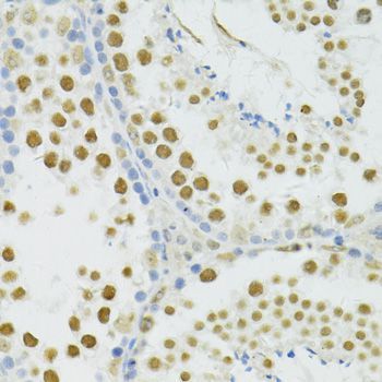 Immunohistochemistry - BRCA1 Polyclonal Antibody (144-11549)