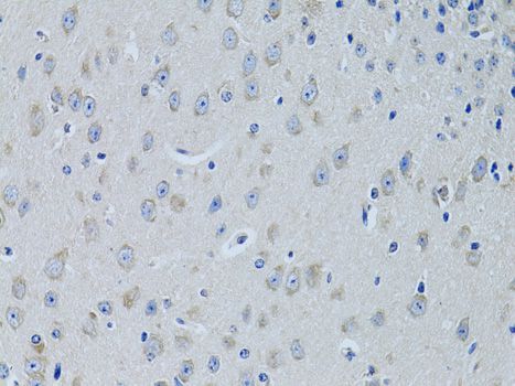 Immunohistochemistry - FDFT1 antibody (144-06229)