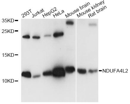 Western blot - NDUFA4L2 antibody (144-60629)