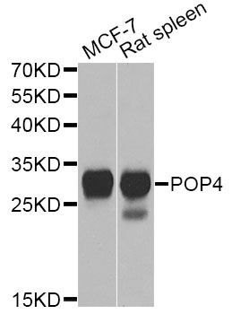Western blot - POP4 Antibody (144-12563)
