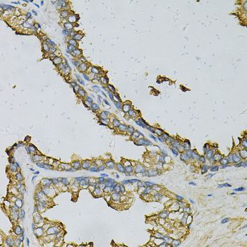 Immunohistochemistry - RPLP0 Antibody (144-013633)