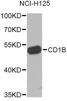 Western blot - CD1B Antibody (144-06551)