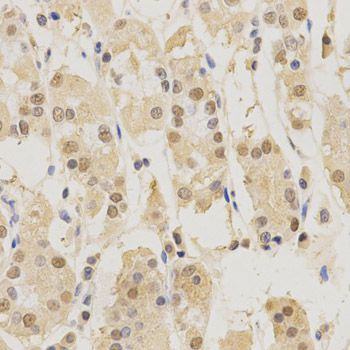 Immunohistochemistry - PSMB5 Polyclonal Antibody (144-01975)