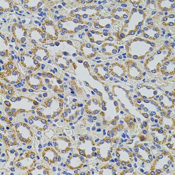 Immunohistochemistry - TRMT2A antibody (144-05975)