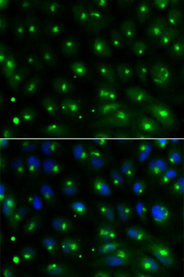 Immunofluorescence - GGA2 antibody (144-01186)