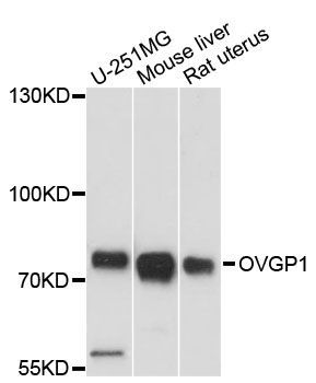 Western blot - OVGP1 antibody (144-013036)