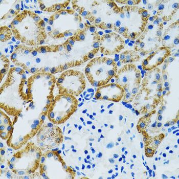 Immunohistochemistry - GDAP1 antibody (144-06601)