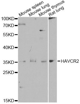 Western blot - HAVCR2 antibody (144-60338)