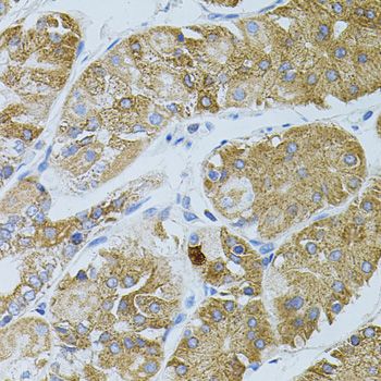 Immunohistochemistry - [KO Validated] GNA13 Polyclonal Antibody (144-05746)