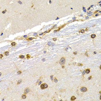 Immunohistochemistry - EEF1D antibody (144-02509)