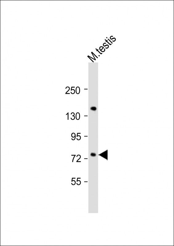 WB