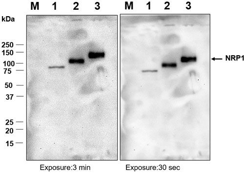 Western blot image