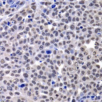 Immunohistochemistry - H2AFY Polyclonal Antibody (144-07045)