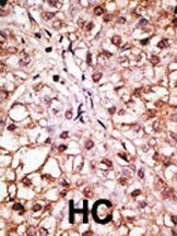 IHC-P
