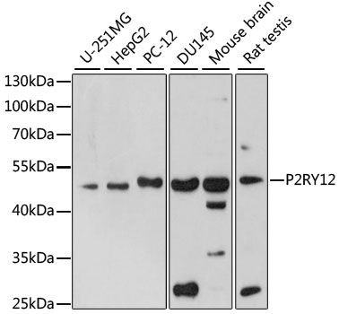 Western blot - P2RY12 antibody (144-61316)
